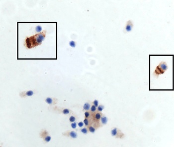 SARS-CoV-2 (COVID-19) Spike S1 Antibody