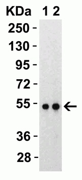 SARS-CoV-2 (COVID-19) Nucleocapsid Antibody