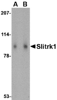 SLITRK1 Antibody