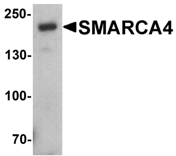SMARCA4 Antibody