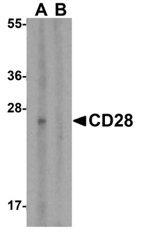 CD28 Antibody