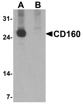 CD160 Antibody