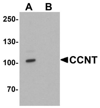 CCNT1 Antibody