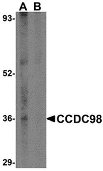 FAM175A Antibody