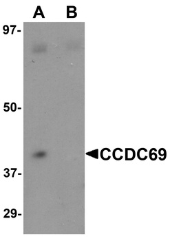 CCDC69 Antibody
