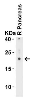 CCDC69 Antibody