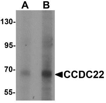 CCDC22 Antibody