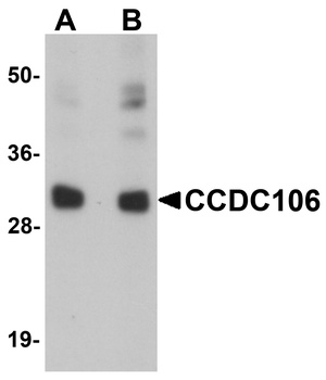 CCDC106 Antibody