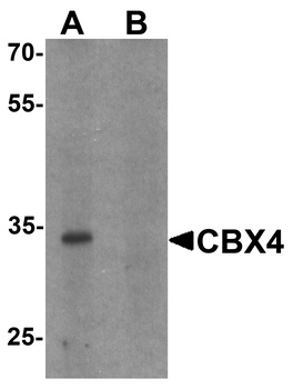 CBX4 Antibody