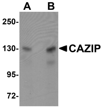 MTUS2 Antibody