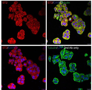 ST2 Antibody