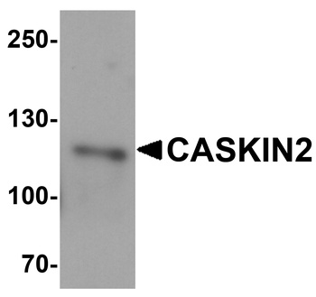 CASKIN2 Antibody