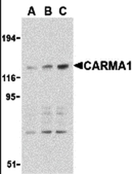 CARD11 Antibody