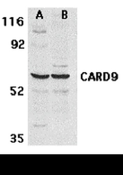 CARD9 Antibody