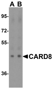 CARD8 Antibody