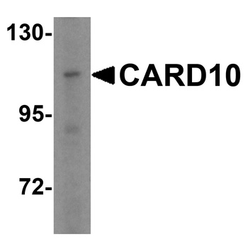 CARD10 Antibody