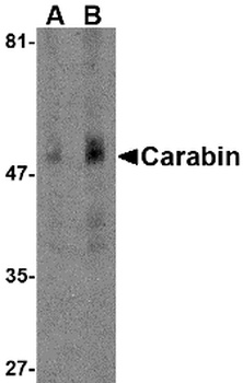Carabin Antibody