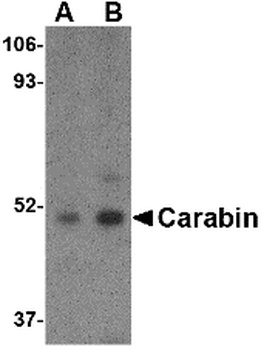 TBC1D10C Antibody