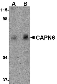 CAPN6 Antibody