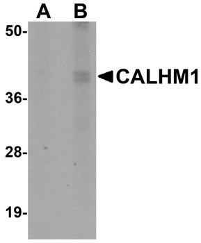 CALHM1 Antibody