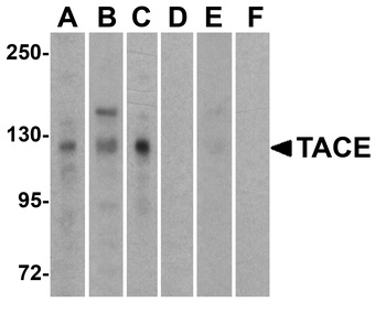 ADAM17 Antibody