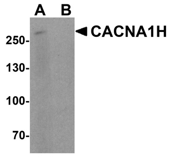 CACNA1H Antibody