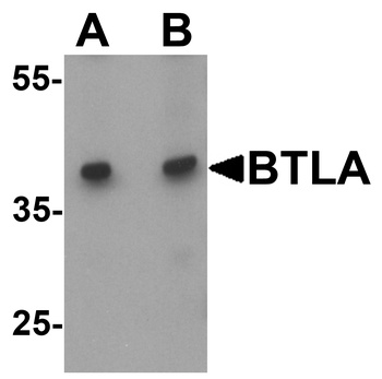 BTLA Antibody