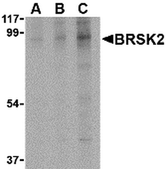 BRSK2 Antibody