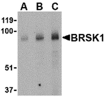 BRSK1 Antibody