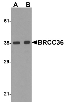 BRCC36 Antibody