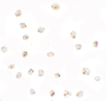 BMP15 Antibody