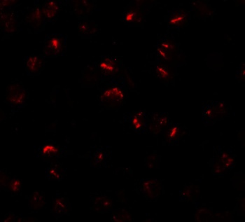 BMP15 Antibody
