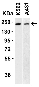 TET1 Antibody