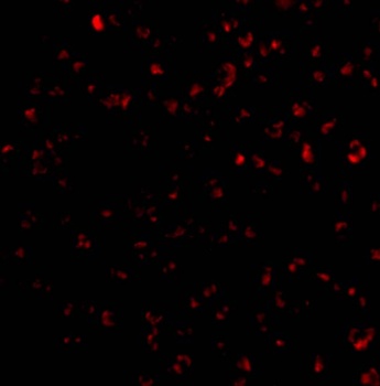 BIK Antibody