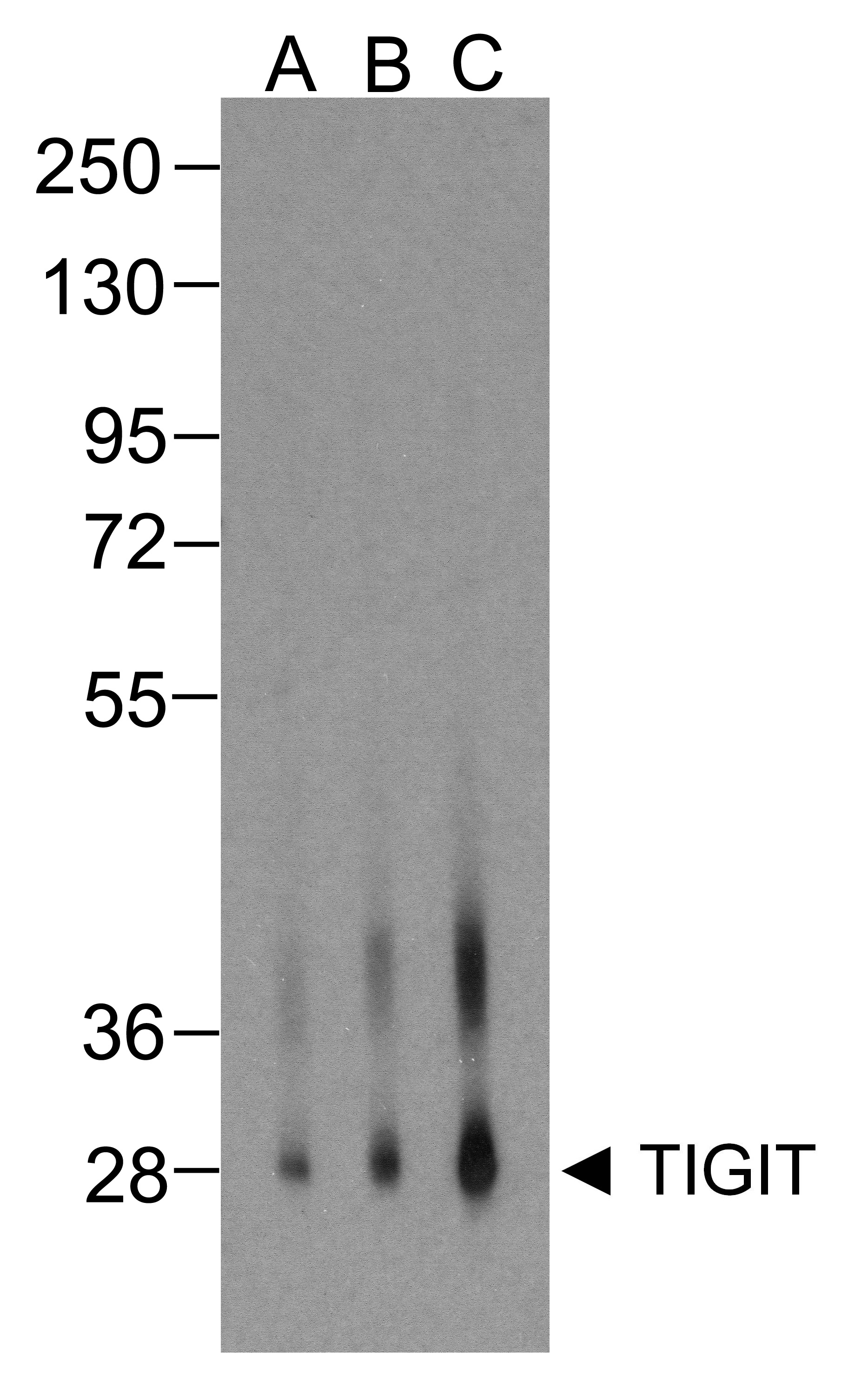 TIGIT Antibody