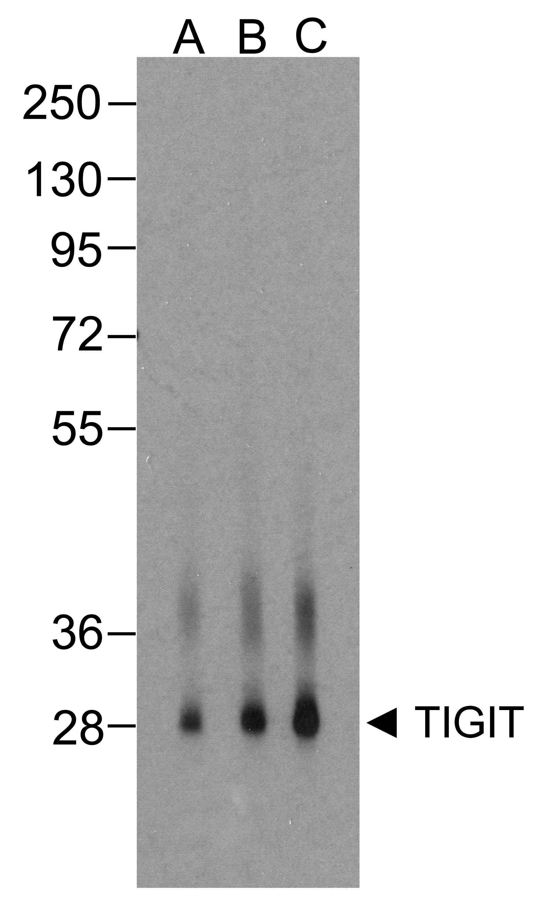 TIGIT Antibody