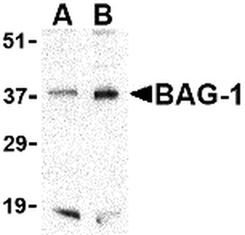 BAG1 Antibody