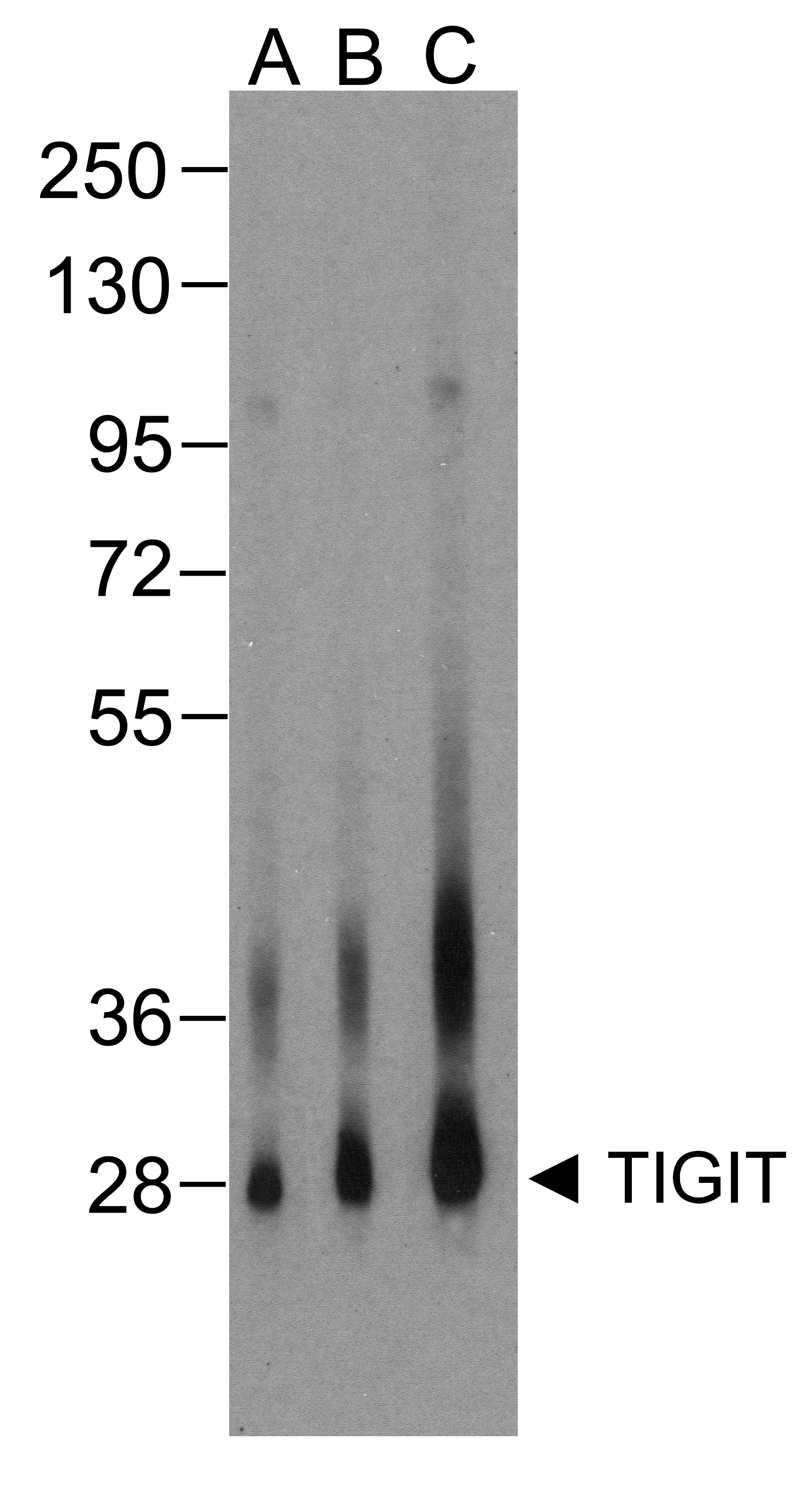 TIGIT Antibody