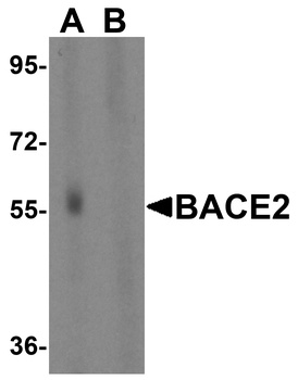BACE2 Antibody