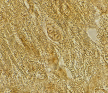 BACE2 Antibody