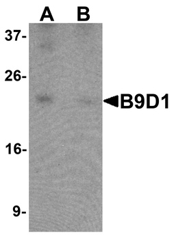 B9D1 Antibody