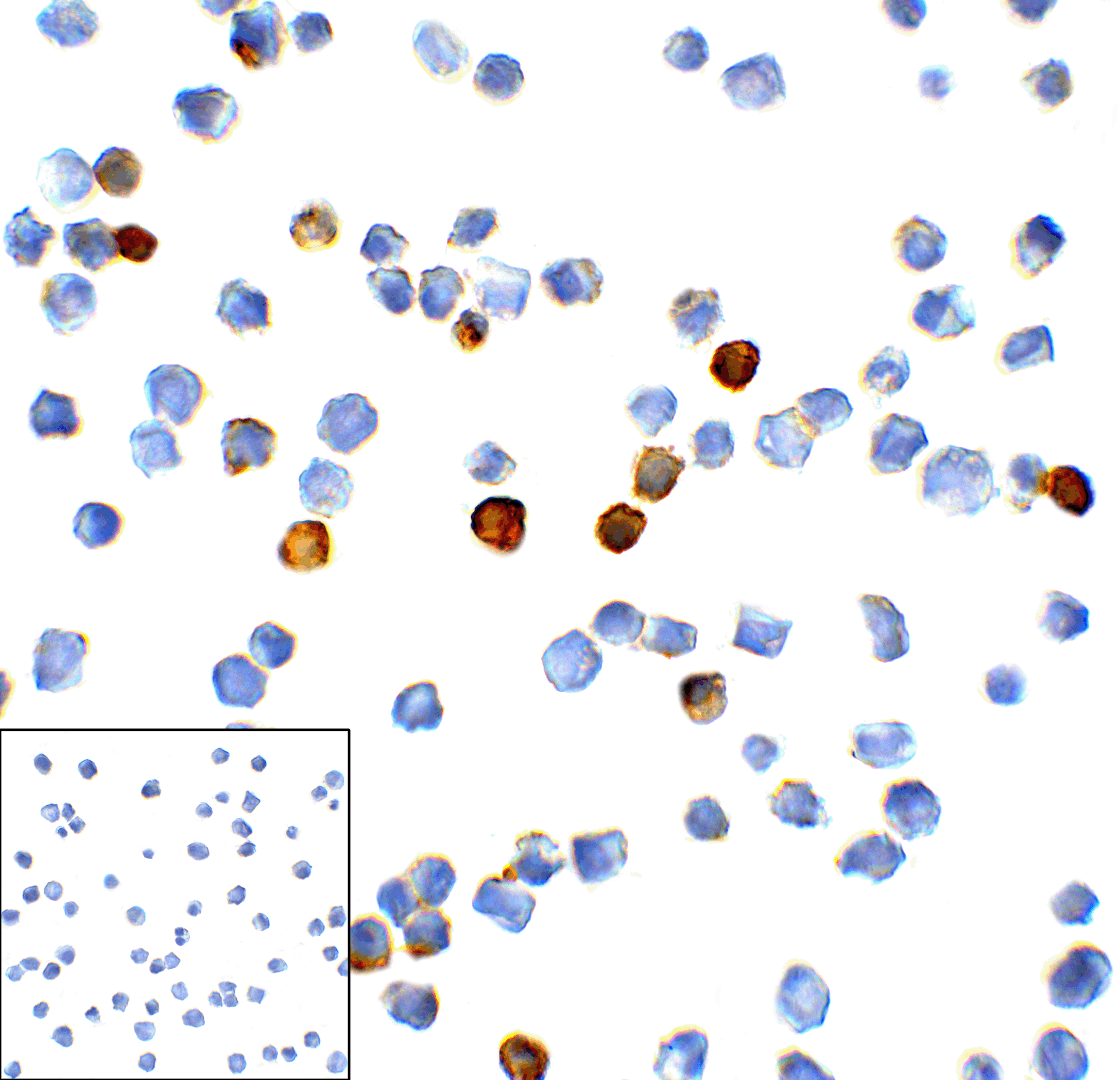 TIM3 Antibody [1B10]
