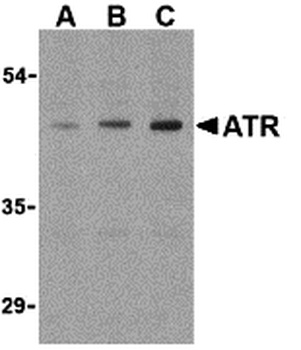ANTXR1 Antibody