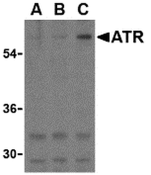 ANTXR1 Antibody