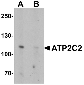 ATP2C2 Antibody