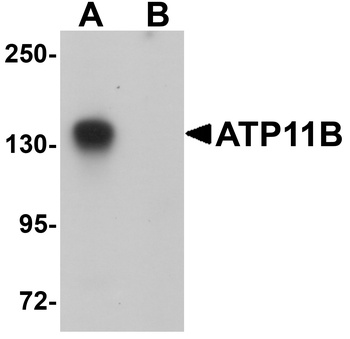 ATP11B Antibody