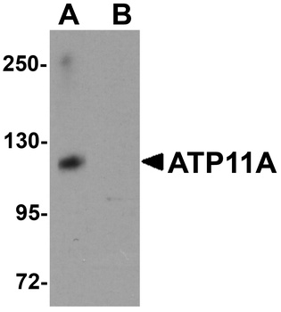 ATP11A Antibody
