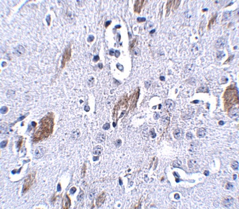 ATOH8 Antibody