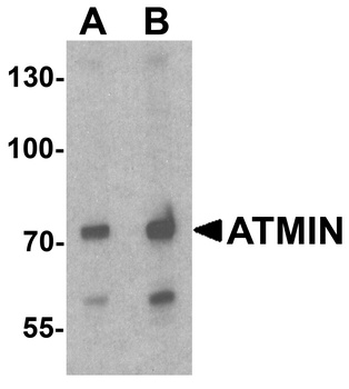 ATMIN Antibody