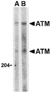 ATM Antibody